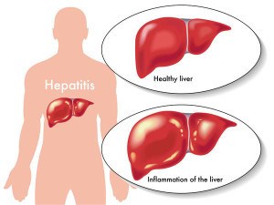 Get checked for Hepatitis C